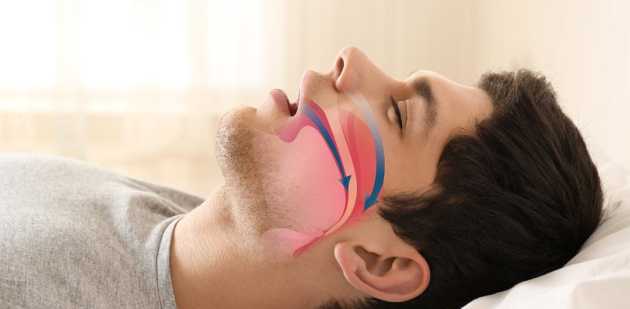 Snoring and Sleep Apnea